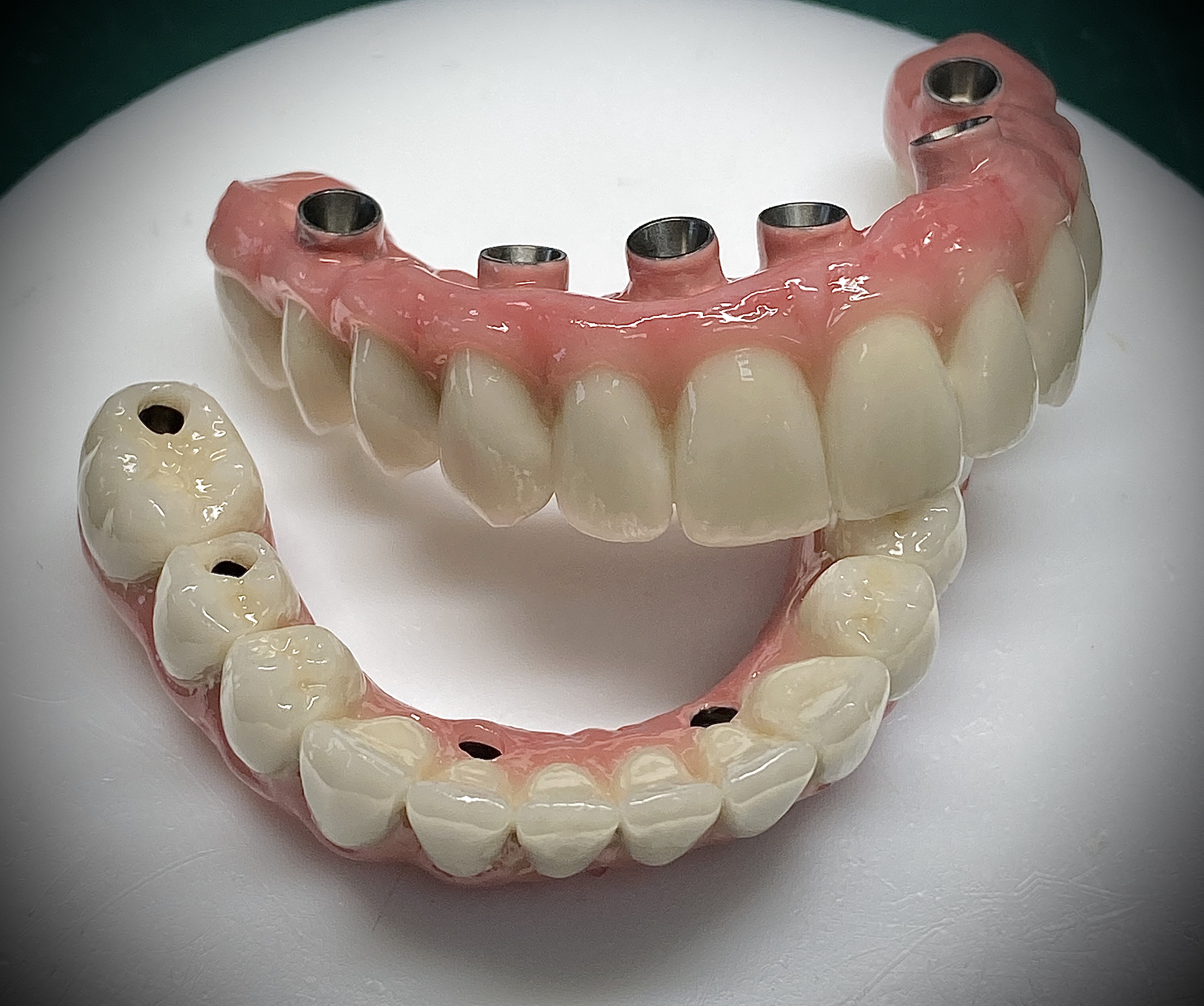 зубной мост на 3 зуба